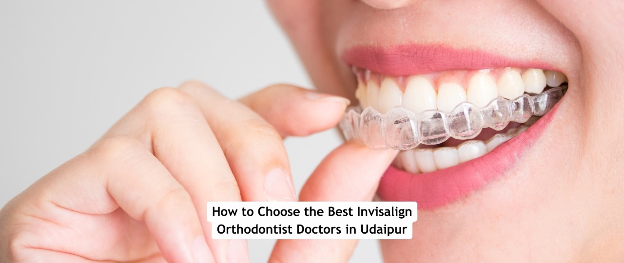 Best Invisalign Orthodontist Doctors in Udaipur